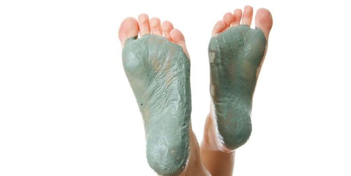 clay for foot fungus