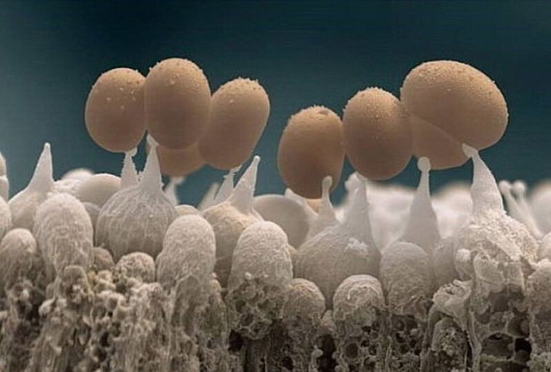 nail fungus under a microscope