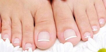 Prevention of the appearance of the fungus on the nails of the legs