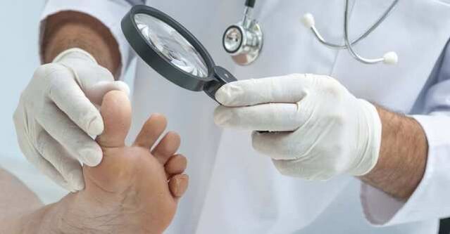 foot examination for fungal infection