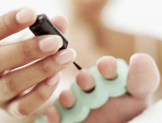 treating nails with nail polish for a fungal infection